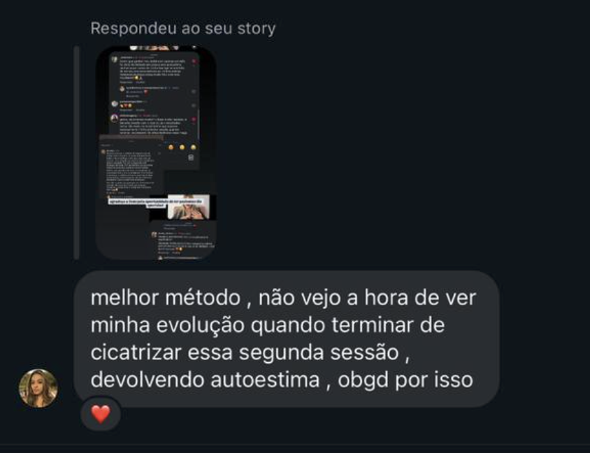 Print de WhatsApp: paciente agradece resultado do tratamento de estrias com o Método SM