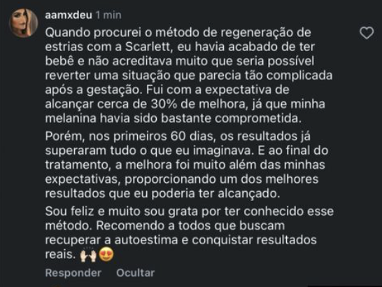 Depoimento de paciente mostrando melhora visível das estrias após tratamento