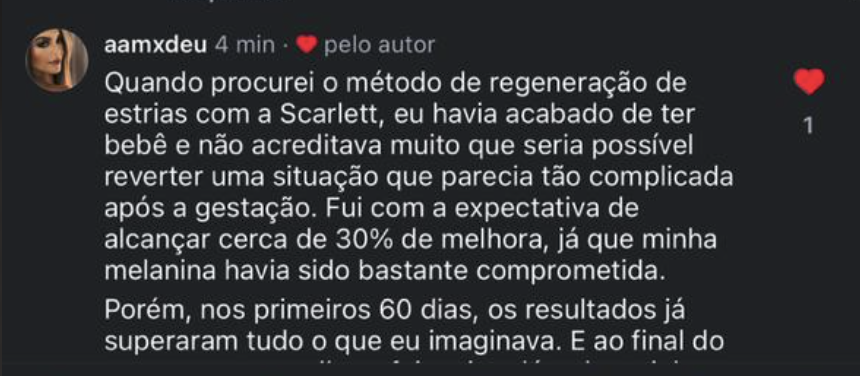 Depoimento real de paciente satisfeita após sessão de tratamento de estrias com Scarllet Mery